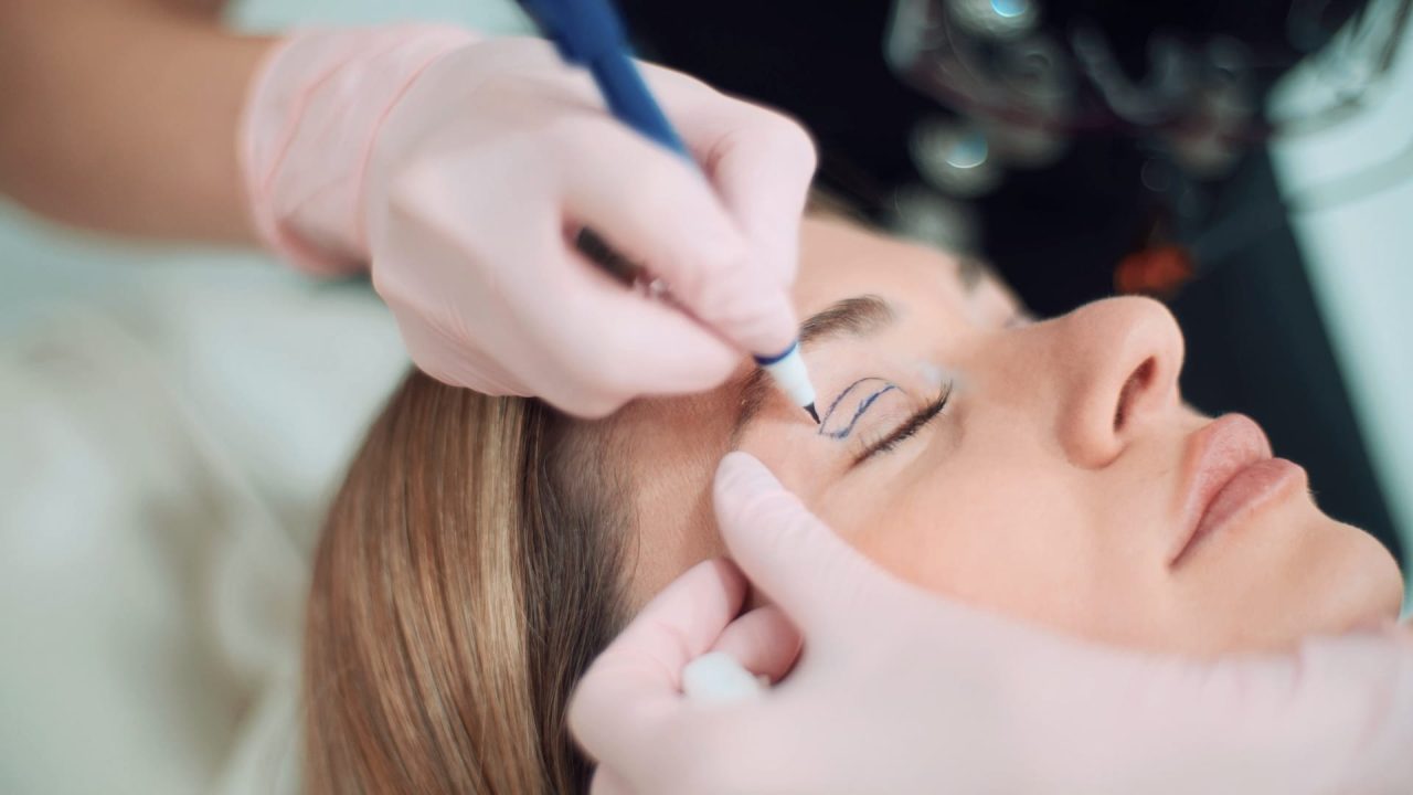Chirurgie Plastică și Estetică 2 blefaroplastie